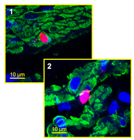 Illustration for article titled Could mammal bladders lead to amphibian-like organ regeneration in humans?